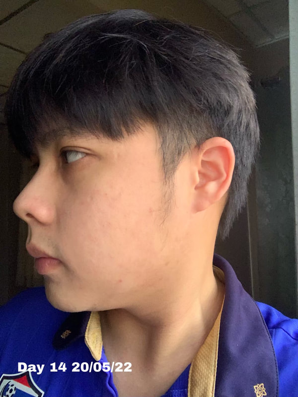 maXkin