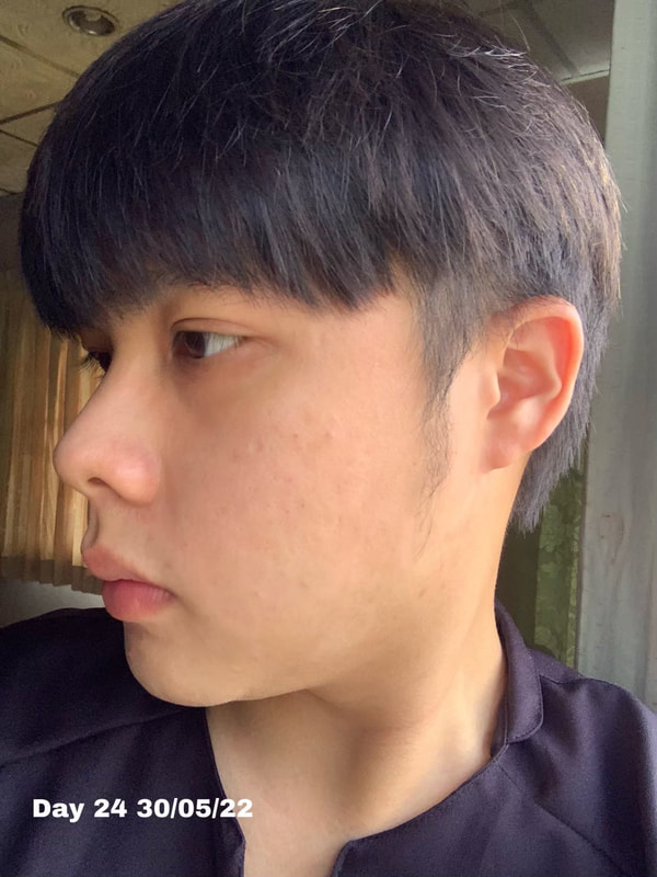 maXkin