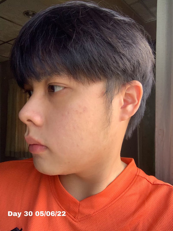 maXkin