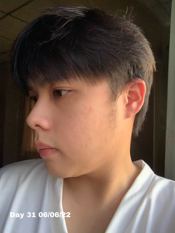maXkin