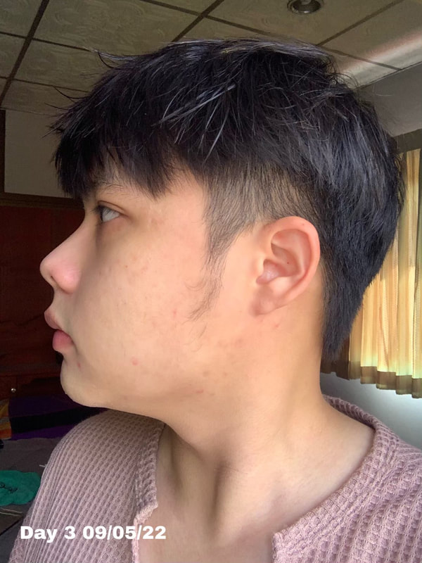 maXkin