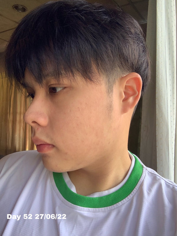 maXkin