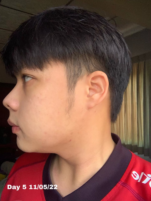 maXkin
