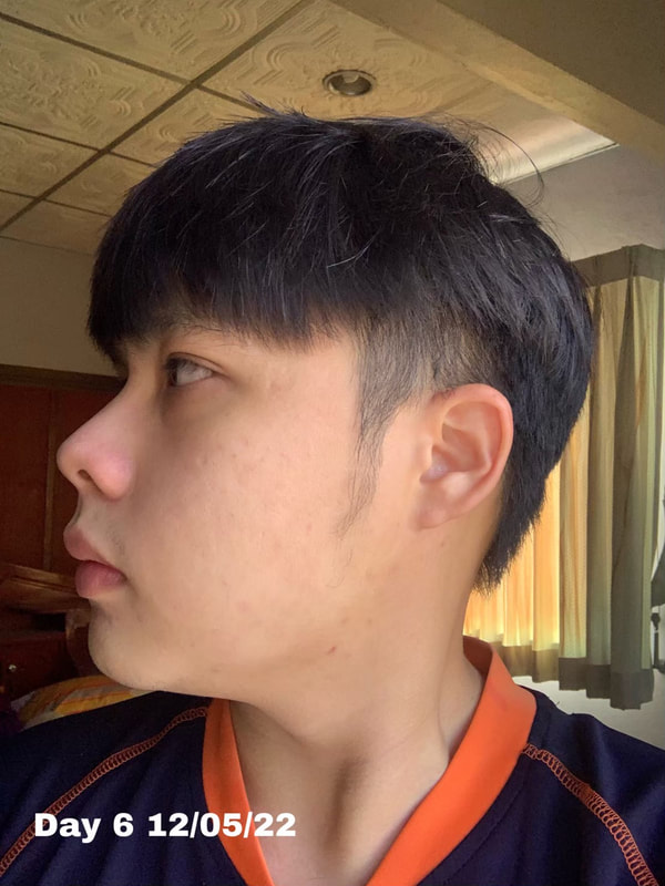 maXkin