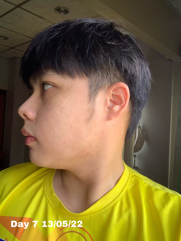 maXkin