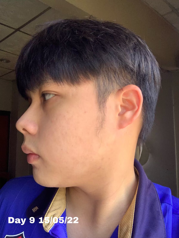 maXkin