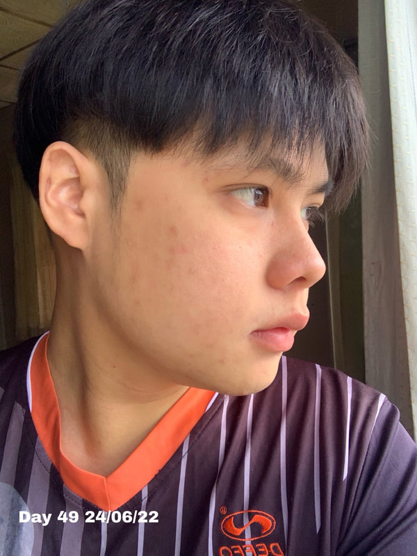 maXkin