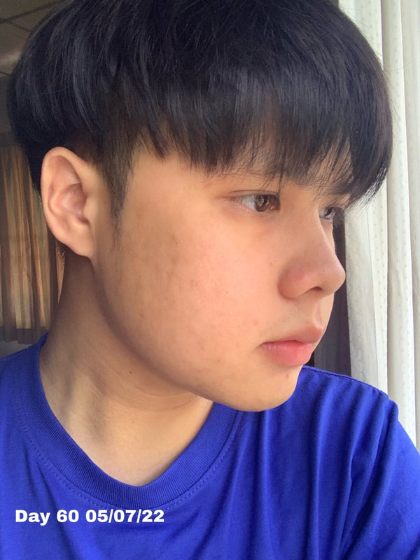 maXkin