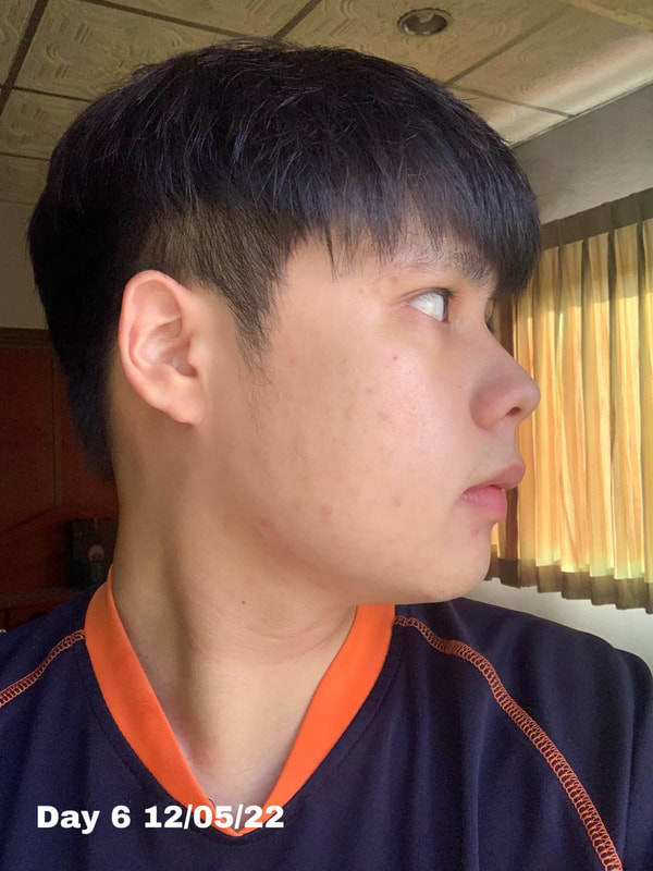 maXkin
