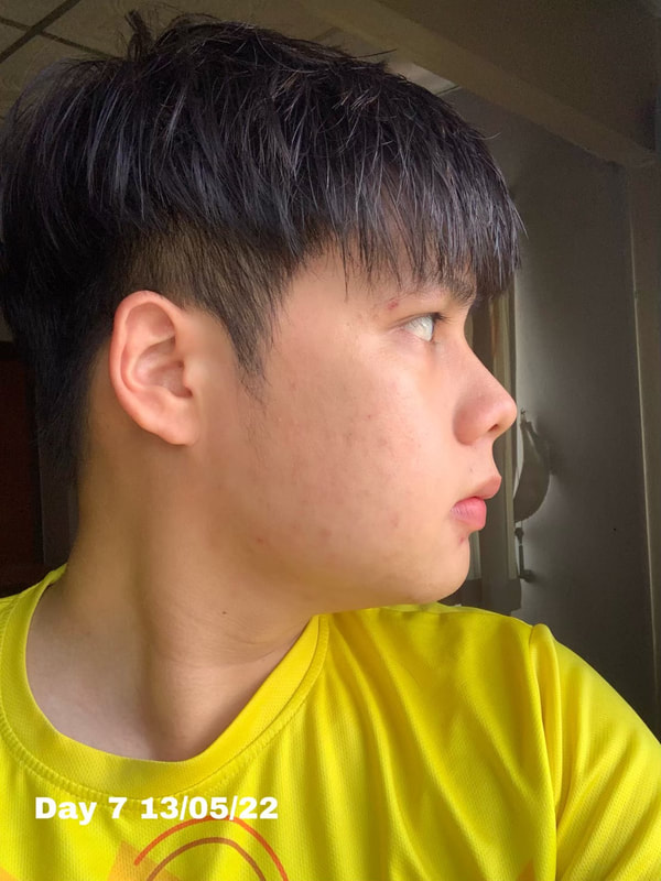 maXkin