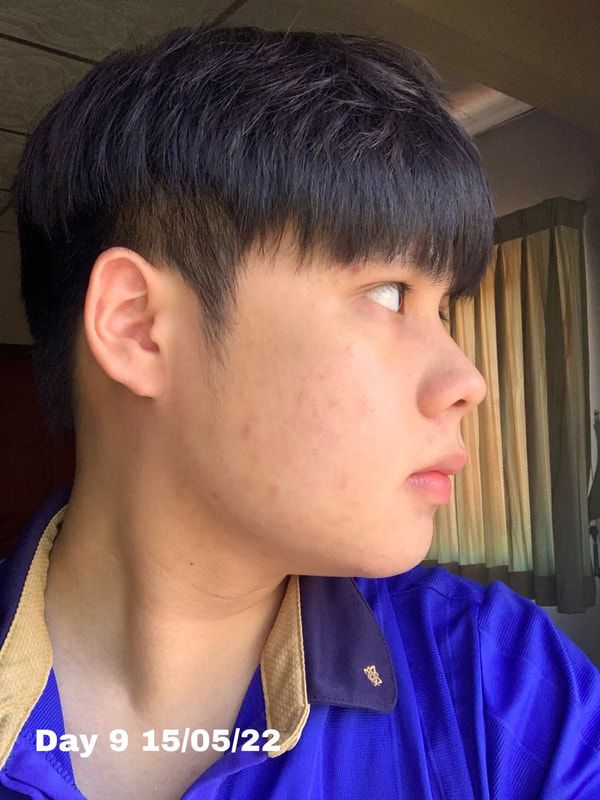 maXkin