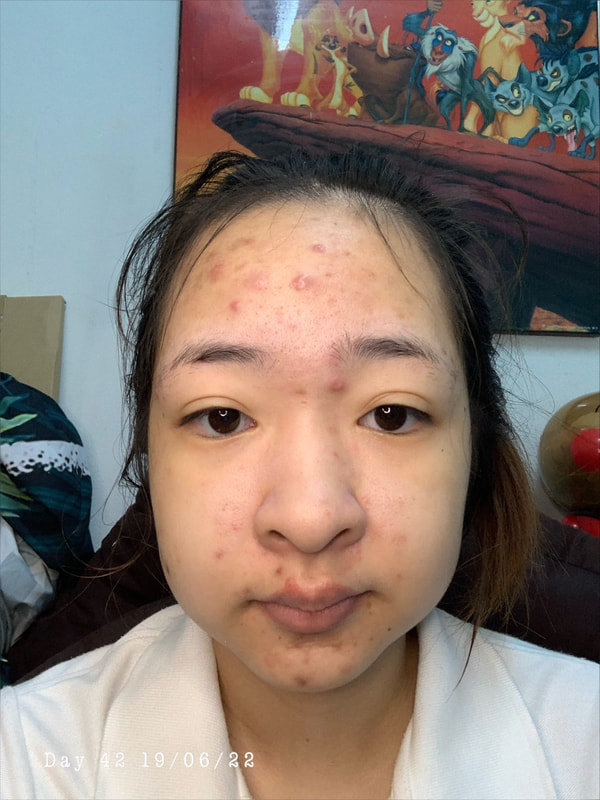 maXkin