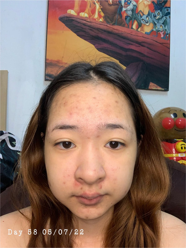maXkin