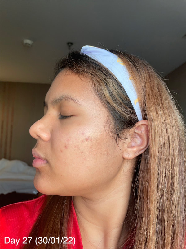 maXkin