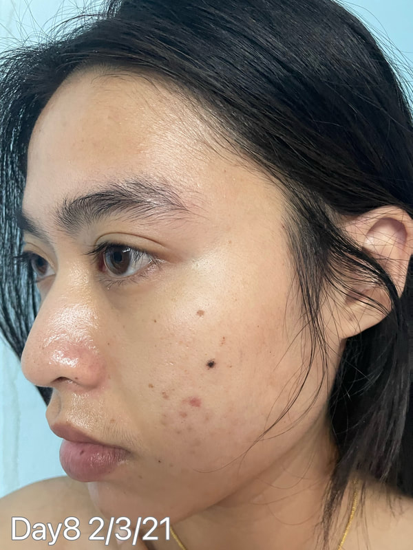 maXkin