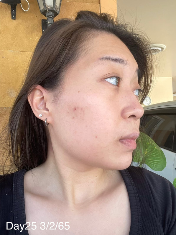 maXkin