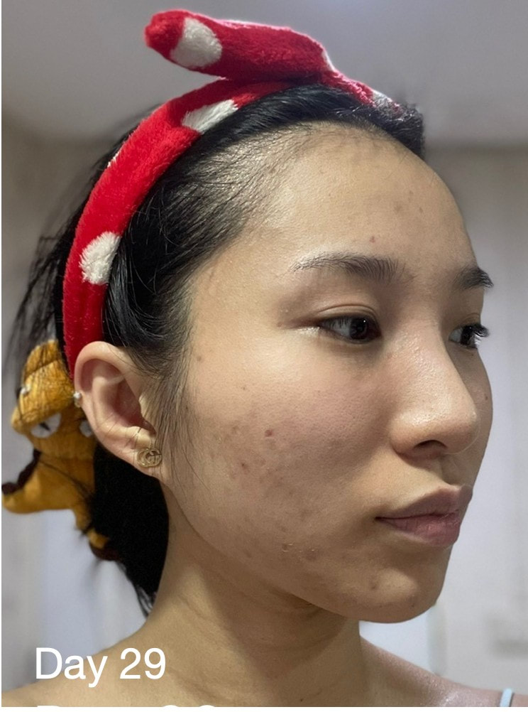 maXkin
