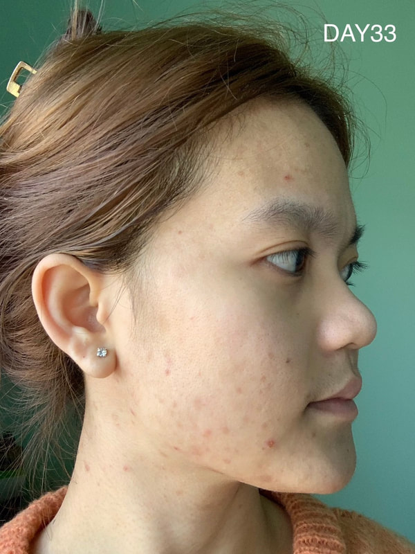 maXkin