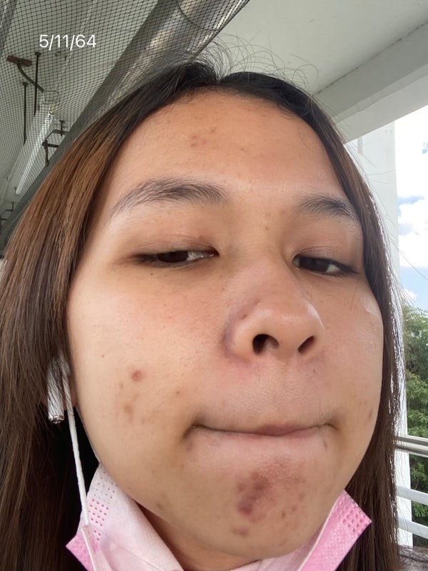 maXkin