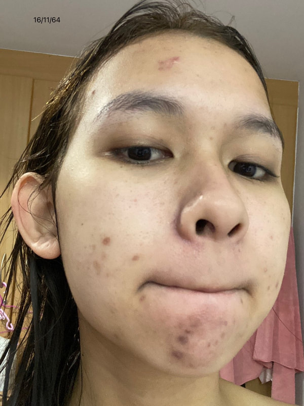 maXkin