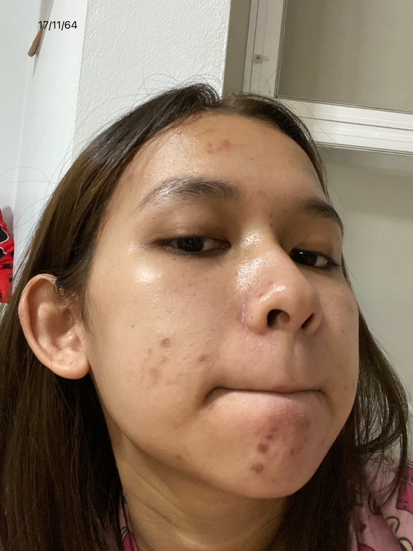 maXkin