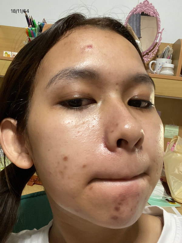 maXkin