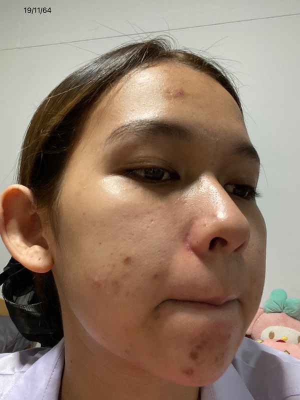 maXkin