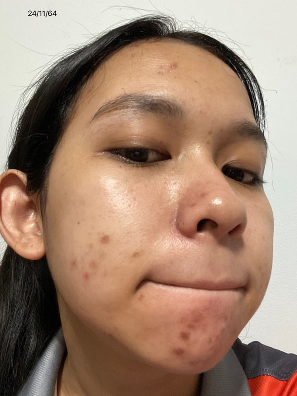 maXkin