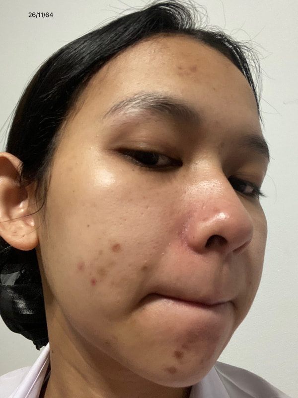 maXkin