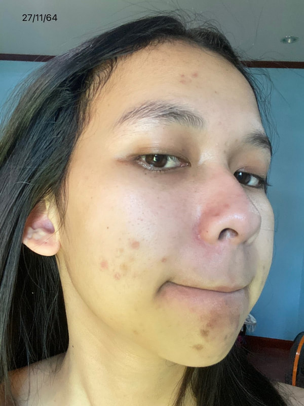 maXkin