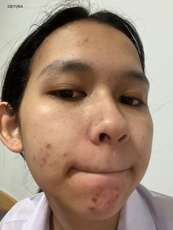 maXkin