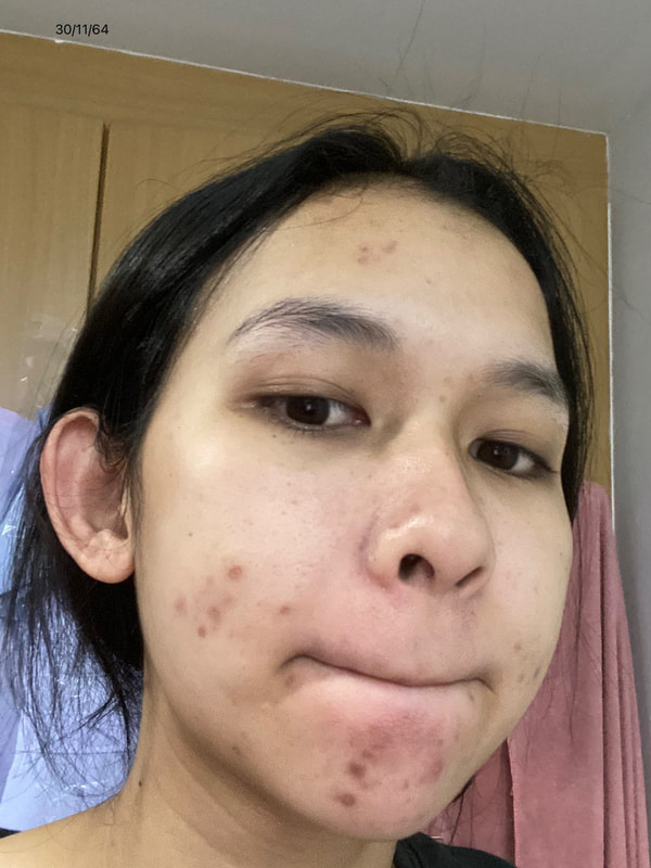 maXkin